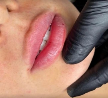 Bellissima Beauty Aesthetics